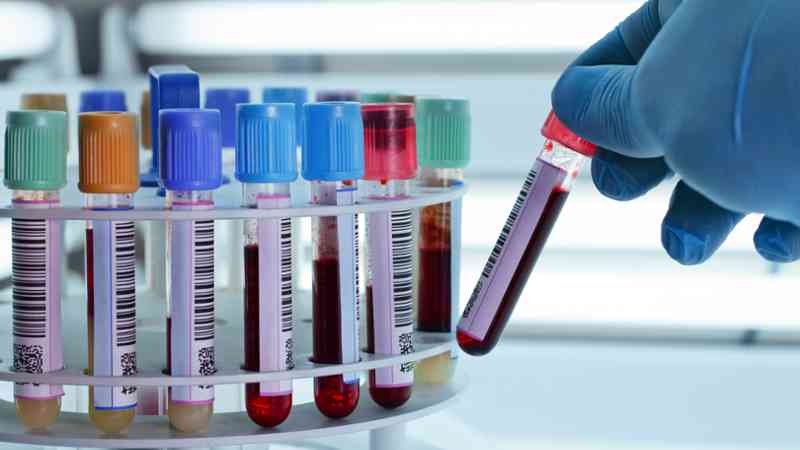 La provincia empadrona a bioquímicos para trabajar en el departamento General López