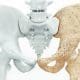 Osteoporosis: la importancia de la detección temprana y los hábitos saludables para minimizar sus riesgos