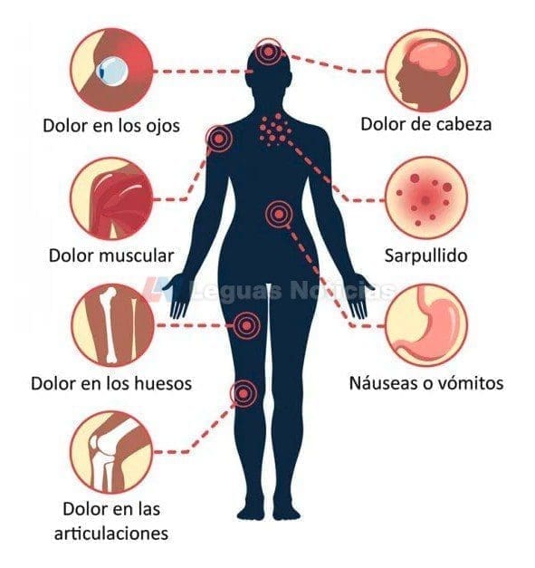 Anunciaron que está lista una vacuna tetravalente contra el Dengue Anunciaron que está lista una vacuna tetravalente contra el Dengue
